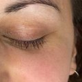 Who should not receive microblading?