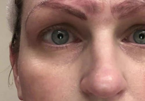 Does microblading ruin your eyebrows?